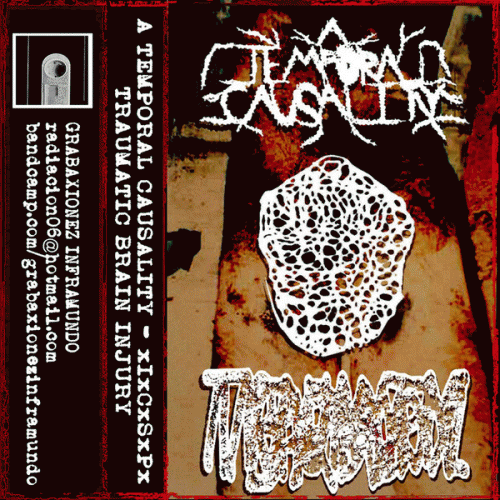 Traumatic Brain Injury : A Temporal Causality - Ihalando Cerebro Senco de Perro - Traumatic Brain Injury Traumatic Brain Injury : A Temporal Causality - Ihalando Cerebro Senco de Perro - Traumatic Brain Injury